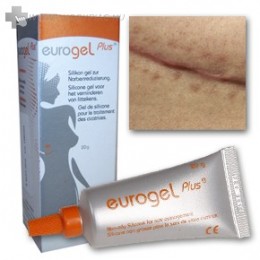 Eurogél plusz szilikonos hegkezelő gél a hegek látható csökkentésére 20 gr